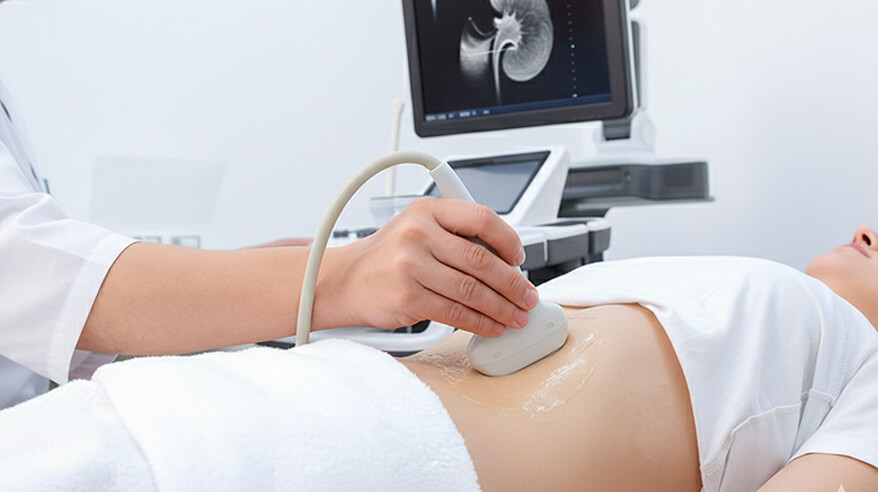 腎臓のエコー検索の写真